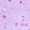 Nuclear Receptor Coactivator 7 antibody, LS-C353631, Lifespan Biosciences, Immunohistochemistry paraffin image 
