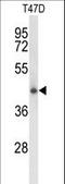 Ceroid-lipofuscinosis neuronal protein 5 antibody, LS-C168846, Lifespan Biosciences, Western Blot image 
