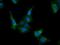 Caseinolytic Mitochondrial Matrix Peptidase Proteolytic Subunit antibody, GTX84679, GeneTex, Immunofluorescence image 