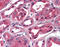 Sodium Channel Epithelial 1 Gamma Subunit antibody, TA317268, Origene, Immunohistochemistry paraffin image 