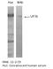 Sideroflexin 1 antibody, TA352905L, Origene, Western Blot image 