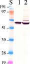 Retinoid Isomerohydrolase RPE65 antibody, ab78036, Abcam, Western Blot image 