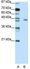 Ribosomal Oxygenase 2 antibody, TA345456, Origene, Western Blot image 