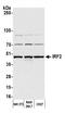 Interferon Regulatory Factor 2 antibody, A303-380A, Bethyl Labs, Western Blot image 