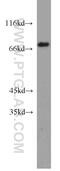 Tumor Protein P63 antibody, 12143-1-AP, Proteintech Group, Western Blot image 