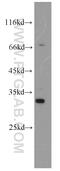 Fibrinogen Like 1 antibody, 16000-1-AP, Proteintech Group, Western Blot image 