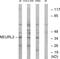 Neuralized E3 Ubiquitin Protein Ligase 2 antibody, GTX87459, GeneTex, Western Blot image 