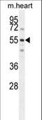 Spermatogenesis And Centriole Associated 1 antibody, LS-C161431, Lifespan Biosciences, Western Blot image 