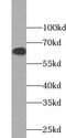 Protein AATF antibody, FNab00025, FineTest, Western Blot image 