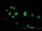 Nuclear receptor subfamily 4 group A member 3 antibody, H00008013-M06, Novus Biologicals, Immunocytochemistry image 