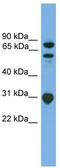 SH3 Domain Containing Kinase Binding Protein 1 antibody, TA334953, Origene, Western Blot image 