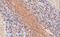Synaptosome Associated Protein 25 antibody, 45-149, ProSci, Enzyme Linked Immunosorbent Assay image 