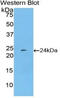 Pentraxin 3 antibody, LS-C295776, Lifespan Biosciences, Western Blot image 