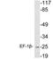 Eukaryotic Translation Elongation Factor 1 Beta 2 antibody, LS-C199838, Lifespan Biosciences, Western Blot image 