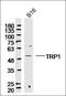 Tyrosinase Related Protein 1 antibody, orb158651, Biorbyt, Western Blot image 