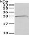 Complement C1q B Chain antibody, PA5-51241, Invitrogen Antibodies, Western Blot image 