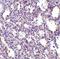 Stromal interaction molecule 2 antibody, NBP1-76791, Novus Biologicals, Immunohistochemistry paraffin image 