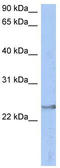 ATPase H+ Transporting V1 Subunit E2 antibody, TA344277, Origene, Western Blot image 
