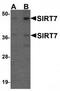 Sirtuin 7 antibody, TA319930, Origene, Western Blot image 