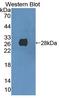 Cyclin Dependent Kinase 16 antibody, LS-C373277, Lifespan Biosciences, Western Blot image 