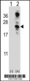 Human Chorionic gonadotrophin antibody, LS-C168714, Lifespan Biosciences, Western Blot image 