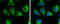 3-ketoacyl-CoA thiolase, mitochondrial antibody, GTX115417, GeneTex, Immunofluorescence image 