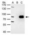 Protein Arginine Methyltransferase 7 antibody, GTX116570, GeneTex, Immunoprecipitation image 