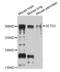 SET Domain Containing 2, Histone Lysine Methyltransferase antibody, orb136864, Biorbyt, Western Blot image 