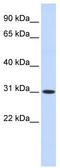 Cytochrome B5 Domain Containing 2 antibody, TA340340, Origene, Western Blot image 