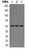 Histone Deacetylase 2 antibody, orb338870, Biorbyt, Western Blot image 