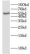 Ectonucleotide Pyrophosphatase/Phosphodiesterase Family Member 5 antibody, FNab02775, FineTest, Western Blot image 