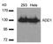 Adducin 1 antibody, AP02702PU-N, Origene, Western Blot image 