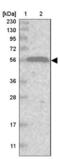 Ras And Rab Interactor 2 antibody, NBP1-80854, Novus Biologicals, Western Blot image 