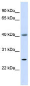 ADA1 antibody, TA339931, Origene, Western Blot image 