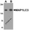 MAP1LC3A antibody, 7951, ProSci Inc, Western Blot image 