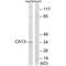Carbonic Anhydrase 13 antibody, A09186, Boster Biological Technology, Western Blot image 
