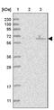 Obscurin Like 1 antibody, PA5-57639, Invitrogen Antibodies, Western Blot image 