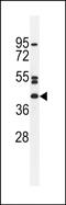 5'-Nucleotidase Domain Containing 4 antibody, PA5-48195, Invitrogen Antibodies, Western Blot image 