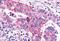 Metabotropic glutamate receptor 6 antibody, MBS244040, MyBioSource, Immunohistochemistry paraffin image 