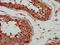 Solute Carrier Family 25 Member 5 antibody, CSB-PA021518LA01HU, Cusabio, Immunohistochemistry frozen image 