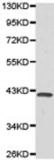 Wnt Family Member 5A antibody, TA324222, Origene, Western Blot image 