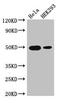 JunD Proto-Oncogene, AP-1 Transcription Factor Subunit antibody, orb400260, Biorbyt, Western Blot image 