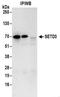 SET Domain Containing 3, Actin Histidine Methyltransferase antibody, NBP2-32136, Novus Biologicals, Immunoprecipitation image 