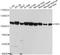 Glucosidase Alpha, Acid antibody, A01548-1, Boster Biological Technology, Western Blot image 
