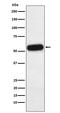 Alpha-2-HS-glycoprotein antibody, M01251-1, Boster Biological Technology, Western Blot image 