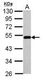 Bleomycin Hydrolase antibody, LS-C155206, Lifespan Biosciences, Western Blot image 