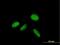 Zinc Finger Protein 584 antibody, H00201514-B01P, Novus Biologicals, Immunofluorescence image 
