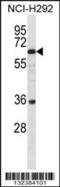 BTB Domain Containing 16 antibody, 56-610, ProSci, Western Blot image 