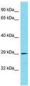 Carbonic Anhydrase 10 antibody, TA335501, Origene, Western Blot image 