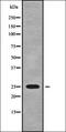 Regulator Of G Protein Signaling 19 antibody, orb338641, Biorbyt, Western Blot image 